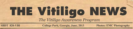 Vitiligo Bond News Clip Vitiligo Bond News Clip
