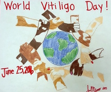 World Vitiligo Day 2016 World Vitiligo Day 2016
