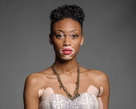 Chantelle Winnie Harlow Chantelle Winnie Harlow