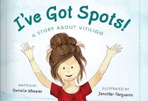 I've Got Spots cover