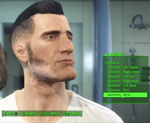 Fallout 4 Video Game Vitiligo Fallout 4 Video Game Vitiligo